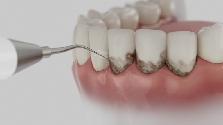 Reliable Dental contractor in Eugene, OR by Smile Center Dentistry